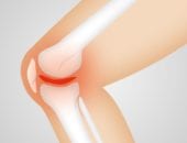 How to keep exercising even if you have bad, painful knees...