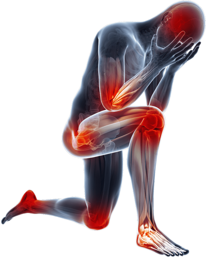 What is Chronic Pain Syndrome